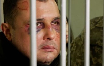 У Шепелева сломаны нос и челюсть, он почти не разговаривает – Матиос