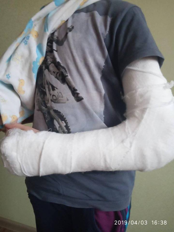 На ребенка упал рентген-аппарат: в больнице в Харькове произошло жуткое ЧП (фото)