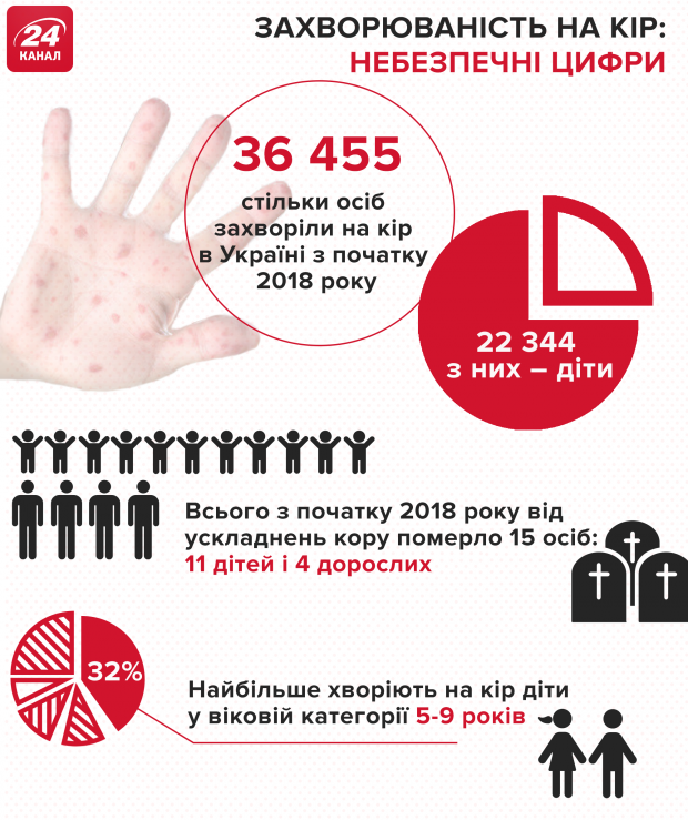 Як вберегтися від кору: все про вакцинацію