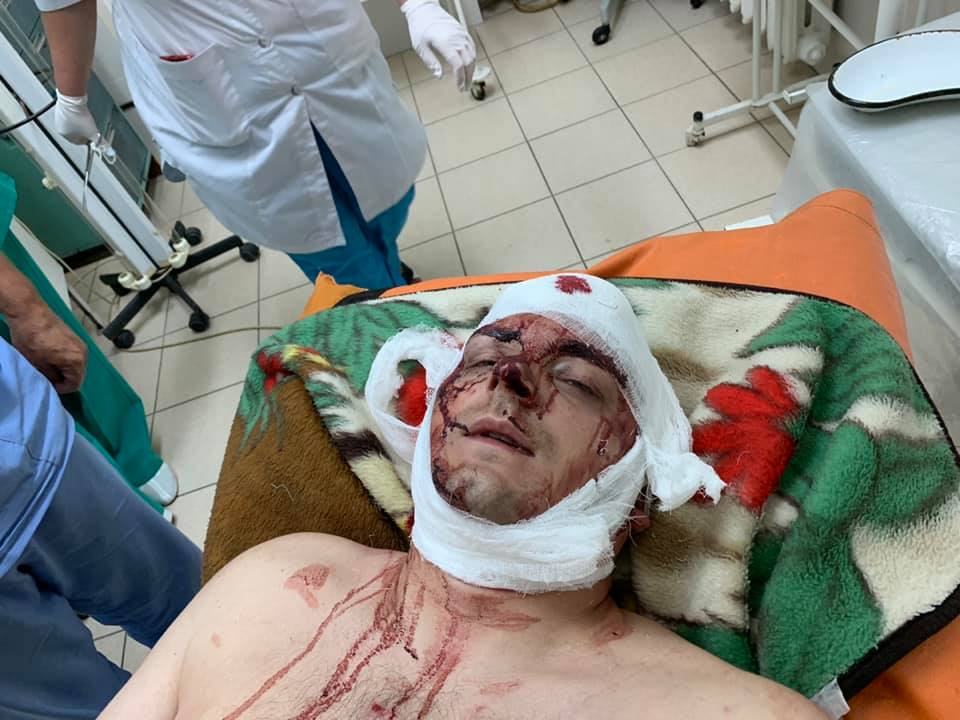 На Сумщине неизвестные жестоко избили экс-мэра Конотопа, полиция расследует покушение на убийство (ФОТО, ВИДЕО)