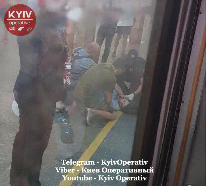 В Киеве на «Контрактовой площади» поезд метро ударил мужчину в голову (ФОТО 18+)
