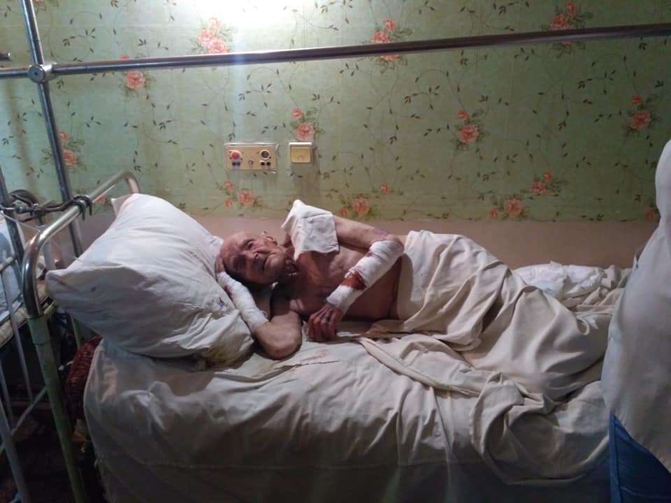 Возвращаться из больницы некуда: стало известно о последствиях обстрела Марьинки (ФОТО)