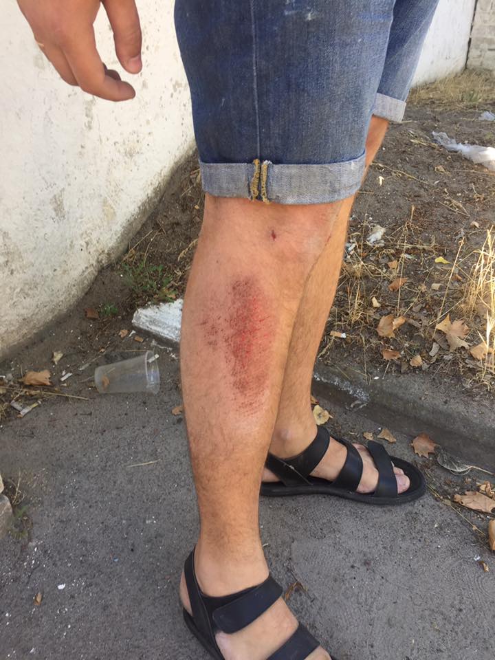 В Херсоне избили журналиста Сергея Никитенко
