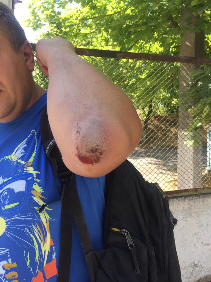 В Херсоне избили журналиста Сергея Никитенко